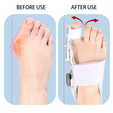 Hallux Valgus Corrector Adjustable For Day Night Use Pain Relief Toe Alignment