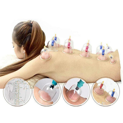 32 Cups Set Vacuum Cupping Suction Massager Kit Massage Acupuncture Pain Relief - Aimall