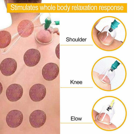 32pcs Vacuum Cupping Massage Set with Pump and Tubing for Relaxation and Body Care