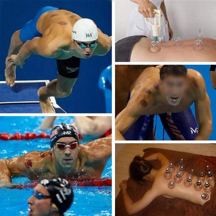 32pcs Vacuum Cupping Massage Set with Pump and Tubing for Relaxation and Body Care
