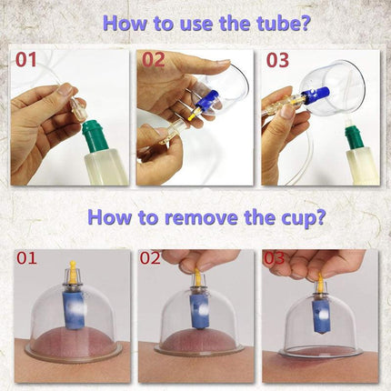 32pcs Vacuum Cupping Massage Set with Pump and Tubing for Relaxation and Body Care