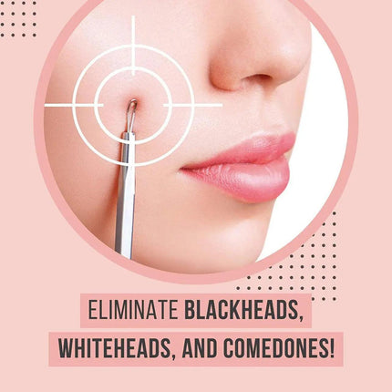 4IN1 Blackhead Pimple Remover Tool Popper Extractor Black Head Tools Set AUStock - Aimall