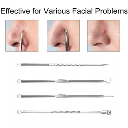 4IN1 Blackhead Pimple Remover Tool Popper Extractor Black Head Tools Set AUStock - Aimall