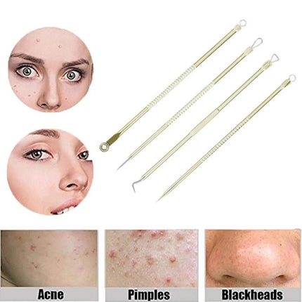 4IN1 Blackhead Pimple Remover Tool Popper Extractor Black Head Tools Set AUStock - Aimall