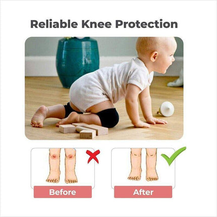 Baby Infant Toddler Crawling Knee Pads Safety Cushion Protector Legs Warmer - Aimall