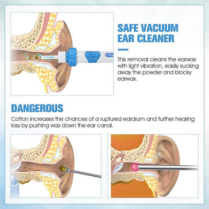 Electric Ear Wax Removal Vacuum Cleaning Cleaner Device Earpick Painless Tool