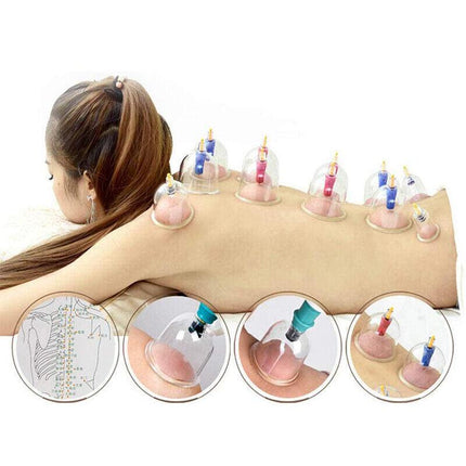 32pcs Vacuum Cupping Massage Set with Pump and Tubing for Relaxation and Body Care