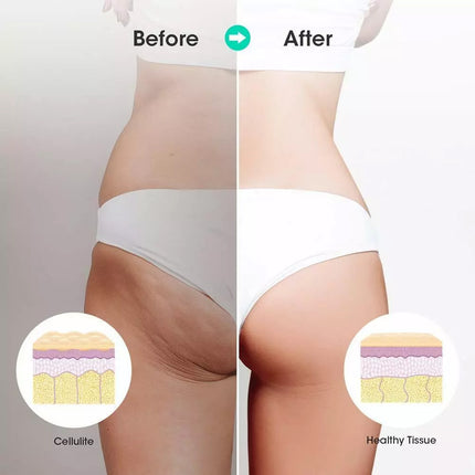 Muscle Roller Stick Full Body Fitness Massage Tool for Home and Gym Use