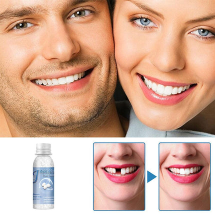 Temporary Tooth Repair Kit Resin Fix Broken False Teeth Fill Gaps Dental Denture - Aimall