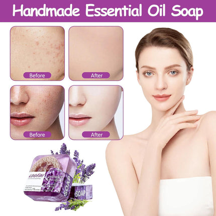 5PCS Loofah Soap Bar Essential Oil Facial Cleansing Exfoliating Bath Body Care