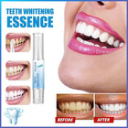 Teeth Whitening Essence, Teeth Whitening Pen, Teeth Whitening Kit 2023 - Aimall