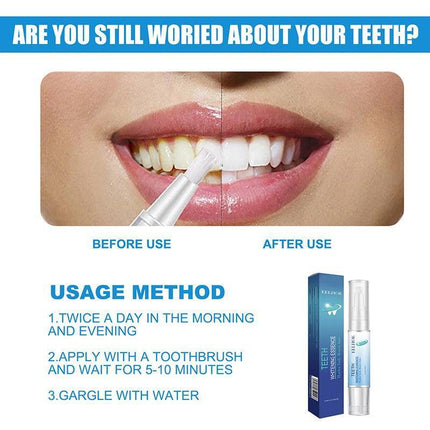 Teeth Whitening Essence, Teeth Whitening Pen, Teeth Whitening Kit 2023 - Aimall