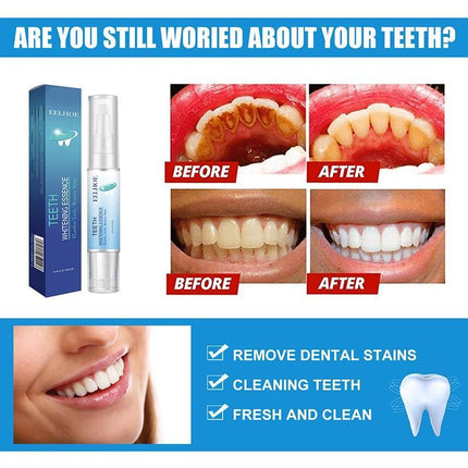 Teeth Whitening Essence, Teeth Whitening Pen, Teeth Whitening Kit 2023 - Aimall
