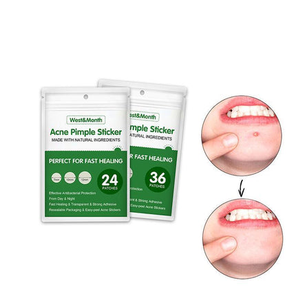 Skin Tag Remover Acne Pimple Patch Removal Facial Care Spot Plaster - Aimall