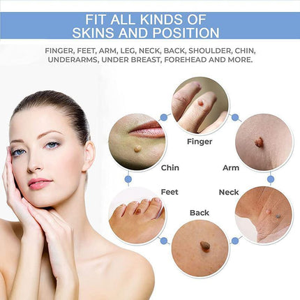 Auto Skin Tag Remover Bands Tool Loader Natural Spot Removal Cleaning Swabs Kit - Aimall