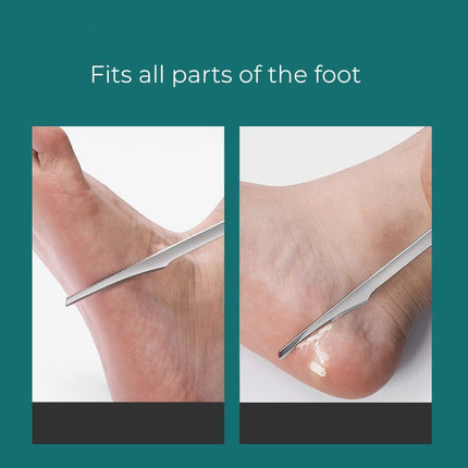 Stainless Foot Corn Remover Hand Foot Care Callus Dead Skin Remover Scraper Foot - Aimall