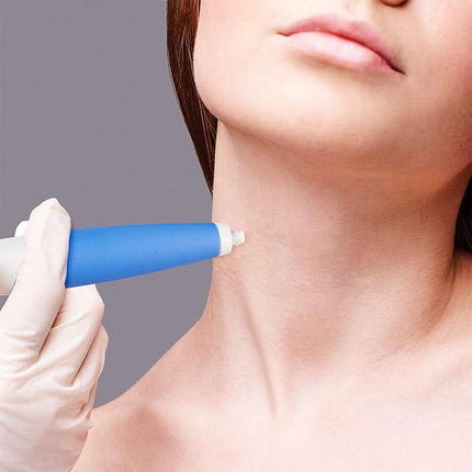 Auto Skin Tag Remover Bands Tool Loader Natural Spot Removal Cleaning Swabs Kit - Aimall