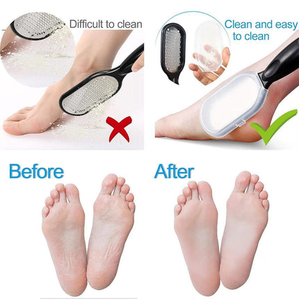 Stainless Foot File Scraper Grater Pedicure Rasp Callus Remover Foot Care Tools - Aimall