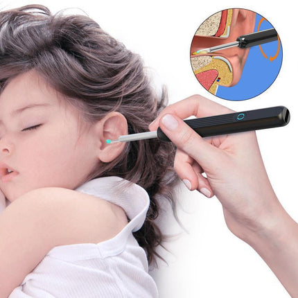 Wi -Fi visible wax elimination spoon, USB 1080P HD load otoscope Aimall