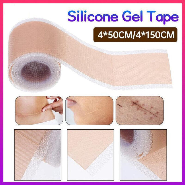 Silicone Gel Tape Scar Removal Self-Adhesive Efficient Scar Removal Patch Tapes - Aimall