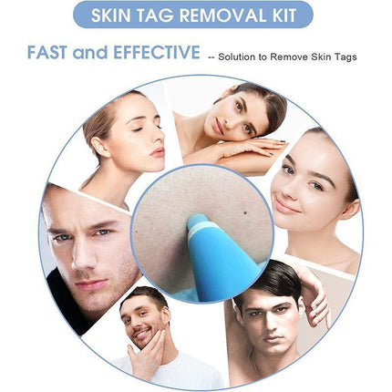 Auto Skin Tag Remover Bands Tool Loader Natural Spot Removal Cleaning Swabs Kit - Aimall