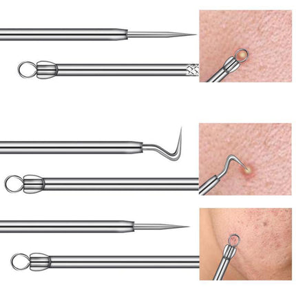 9PCS Blackhead Remover Extractor Tool Pimple Blemish Popper Comedone Kit Clip - Aimall