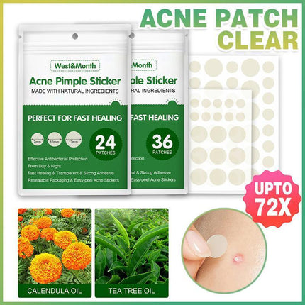 Skin Tag Remover Acne Pimple Patch Removal Facial Care Spot Plaster - Aimall