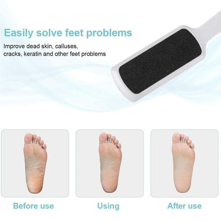 Double Sided Foot File Callus Remover Pedicure Skin Care Sanding Foot File Tool - Aimall