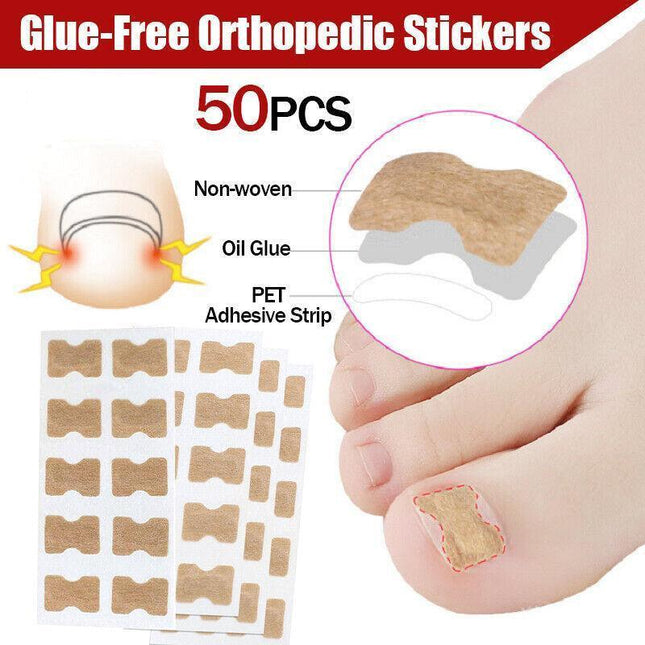 50-100Pcs Glue Free Toenail Toe Ingrown Nail Correction Patch Sticker Foot Care - Aimall