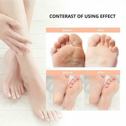 Electric Care Pedicure Kit Foot File Hard Dead Skin Callus Remover Foot Grinder - Aimall