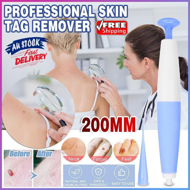 Auto Skin Tag Remover Bands Tool Loader Natural Spot Removal Cleaning Swabs Kit - Aimall