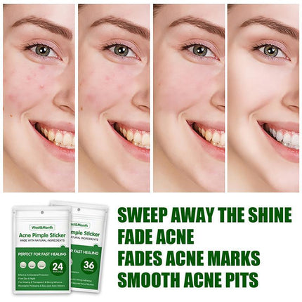 Skin Tag Remover Acne Pimple Patch Removal Facial Care Spot Plaster - Aimall
