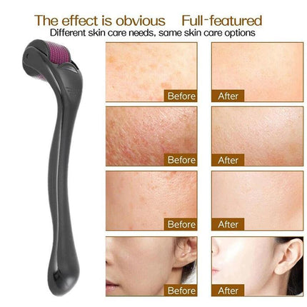 Derma Roller Titanium Micro Needle Skin 540 Needles Scars Anti Aging Dermaroller - Aimall