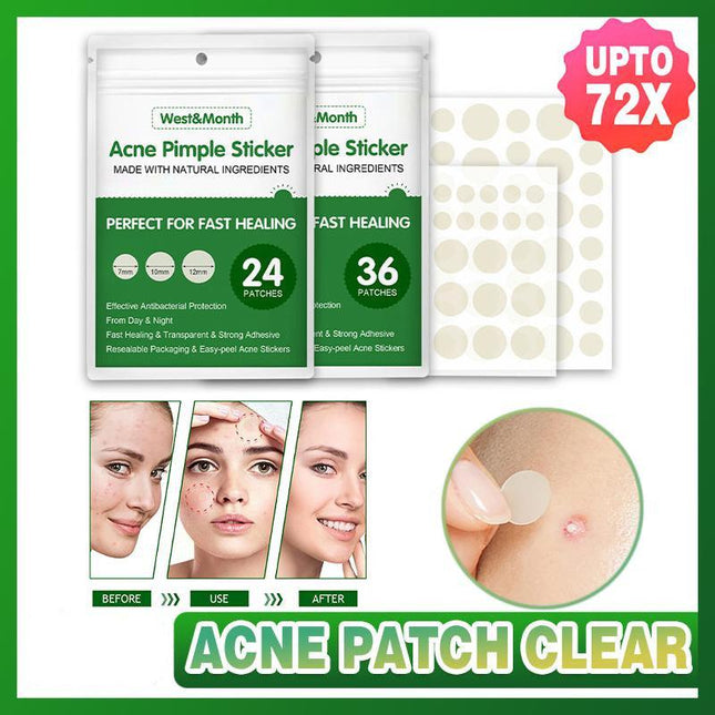 Skin Tag Remover Acne Pimple Patch Removal Facial Care Spot Plaster - Aimall