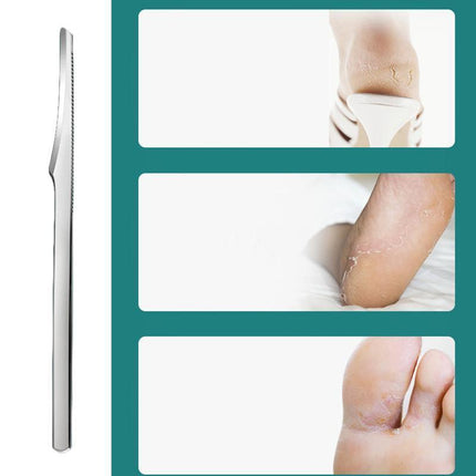 Stainless Foot Corn Remover Hand Foot Care Callus Dead Skin Remover Scraper Foot - Aimall