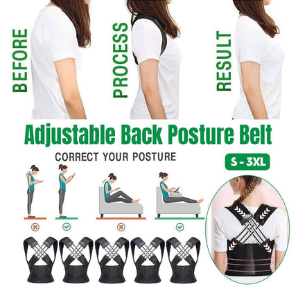 Adjustable Back Posture Corrector Support Belt for Unisex Hunchback Correction