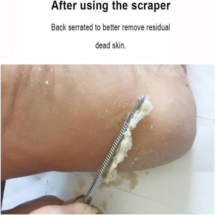 Stainless Foot Corn Remover Hand Foot Care Callus Dead Skin Remover Scraper Foot - Aimall