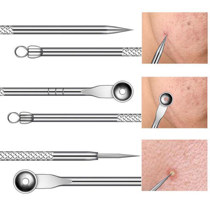 9PCS Blackhead Remover Extractor Tool Pimple Blemish Popper Comedone Kit Clip - Aimall