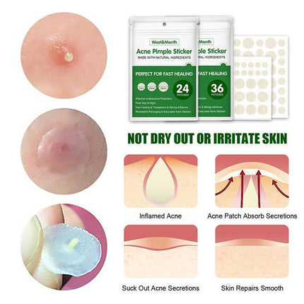 Skin Tag Remover Acne Pimple Patch Removal Facial Care Spot Plaster - Aimall