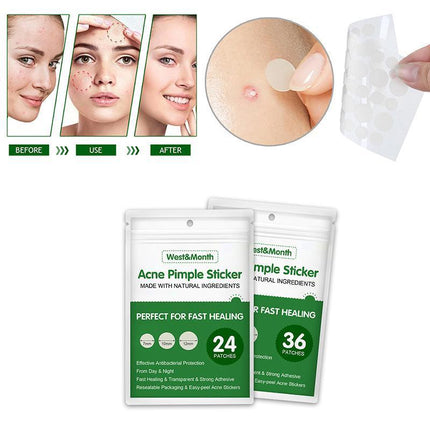 Skin Tag Remover Acne Pimple Patch Removal Facial Care Spot Plaster - Aimall