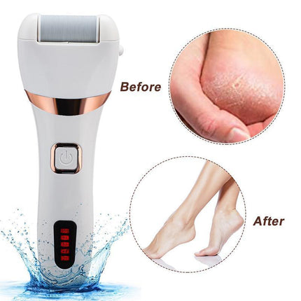 Electric Care Pedicure Kit Foot File Hard Dead Skin Callus Remover Foot Grinder - Aimall