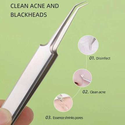 Curved Blackhead Acne Clip Needle Tweezers Pimple Popper Extractor Remover Clean - Aimall