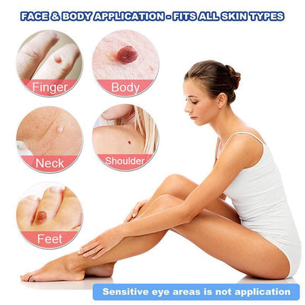 Auto Skin Tag Remover Bands Tool Loader Natural Spot Removal Cleaning Swabs Kit - Aimall