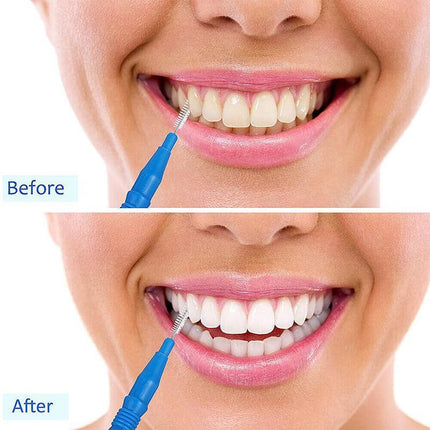 200PCS Interdental Brush Floss Sticks Tooth Floss Head Toothpick Cleaning New Orange - Aimall