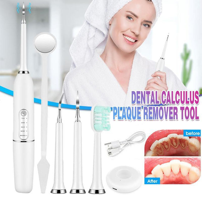 Electric Ultrasonic Dental Calculus Remover Tartar Scaler Scraper Tooth Cleaner - Aimall