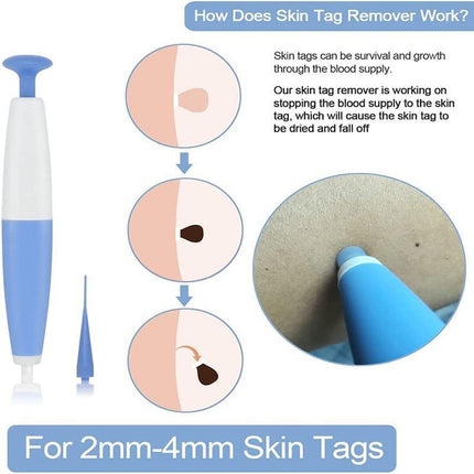 Auto Skin Tag Remover Bands Tool Loader Natural Spot Removal Cleaning Swabs Kit - Aimall