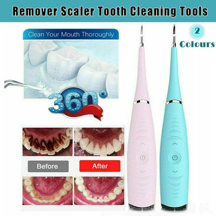 Tooth Stains Tool Dental Scaler Tartar Calculus Plaque Remover Electric Sonic AU - Aimall