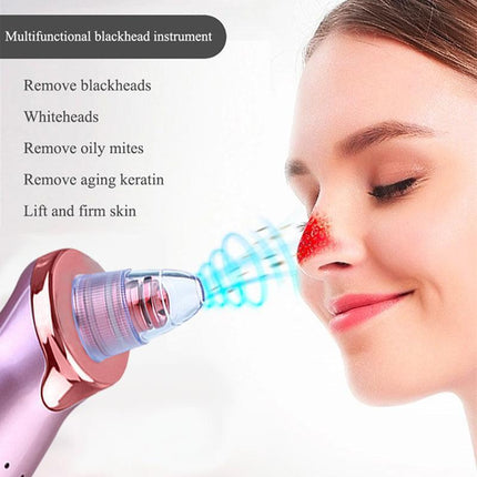 AU Vacuum Blackhead Remover Facial Skin Pore Acne Pimple 5Sucker Cleaner Machine - Aimall