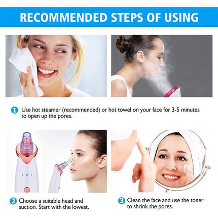 AU Vacuum Blackhead Remover Facial Skin Pore Acne Pimple 5Sucker Cleaner Machine - Aimall