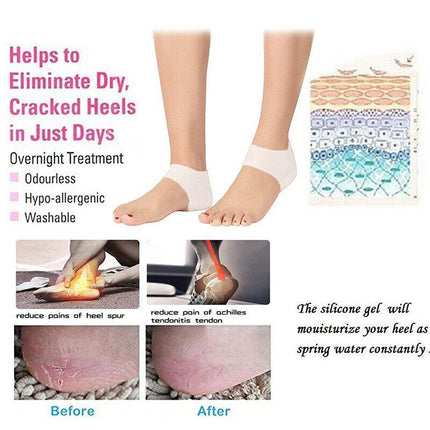 Silicone Gel Heel Socks Cracked Foot Skin Care Protector Sleeve Pain Relief AU - Aimall